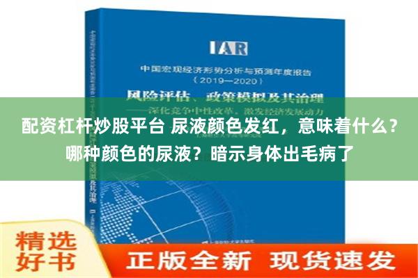 配资杠杆炒股平台 尿液颜色发红，意味着什么？哪种颜色的尿液？暗示身体出毛病了